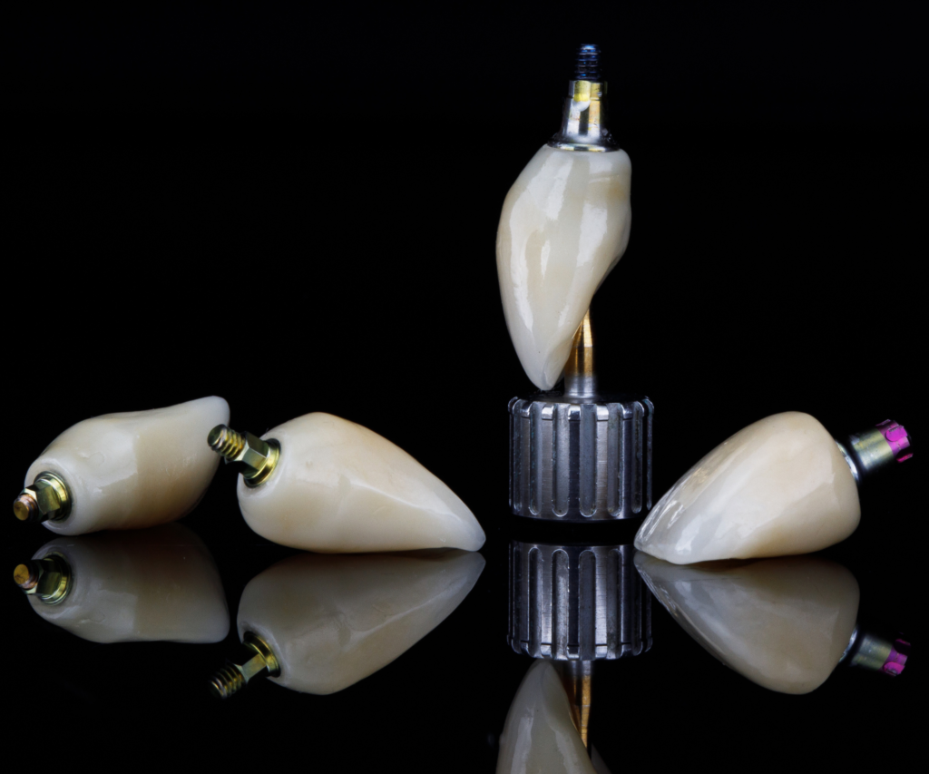 Implantologie couronnes dentaires sur implant
