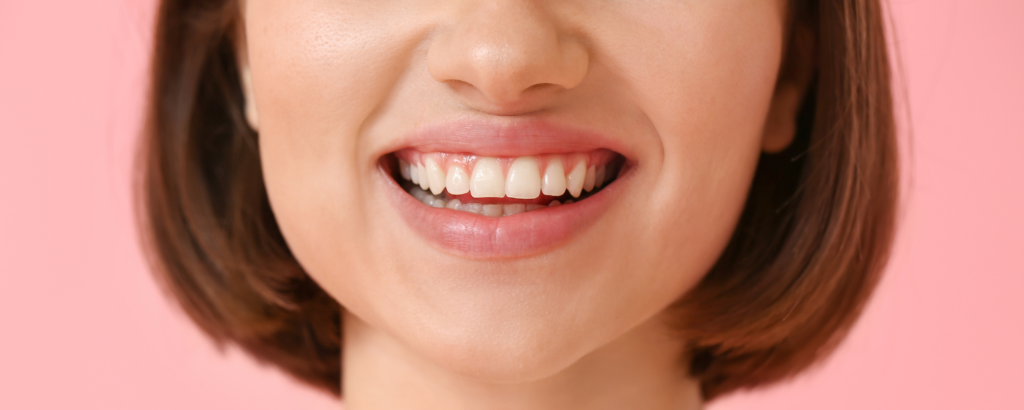 Sourire confiant après une consultation chez Paris Dental Studios pour la parodontie et une bonne hygiène dentaire
