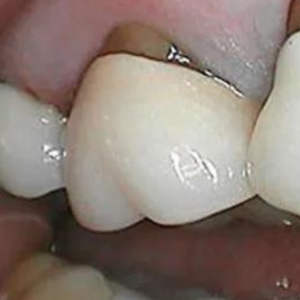 URGENCES DENTAIRES - Consultez un dentiste rapidement ! Prothèse dentaire décollée ? Nos dentistes vous reçoivent rapidement !