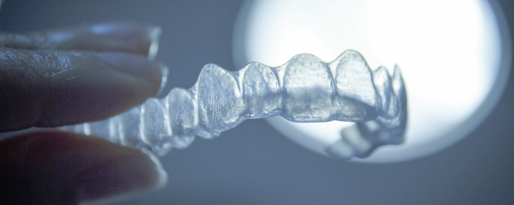 alternatives aux appareils orthodontique