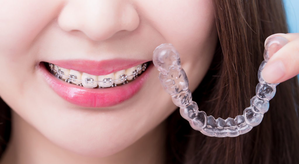 Options de traitement orthodontique