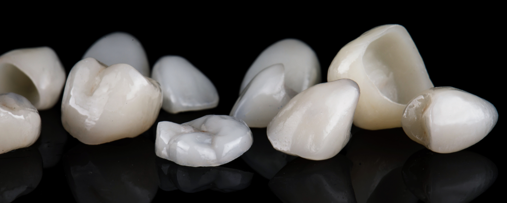 Types de couronnes dentaires : céramique, métal-céramique, zircone - choix personnalisé pour chaque patient