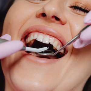 dentiste : blanchiment, aligneurs invisibles, facettes dentaires, implant dentaire, soins dentaires, urgences dentaires