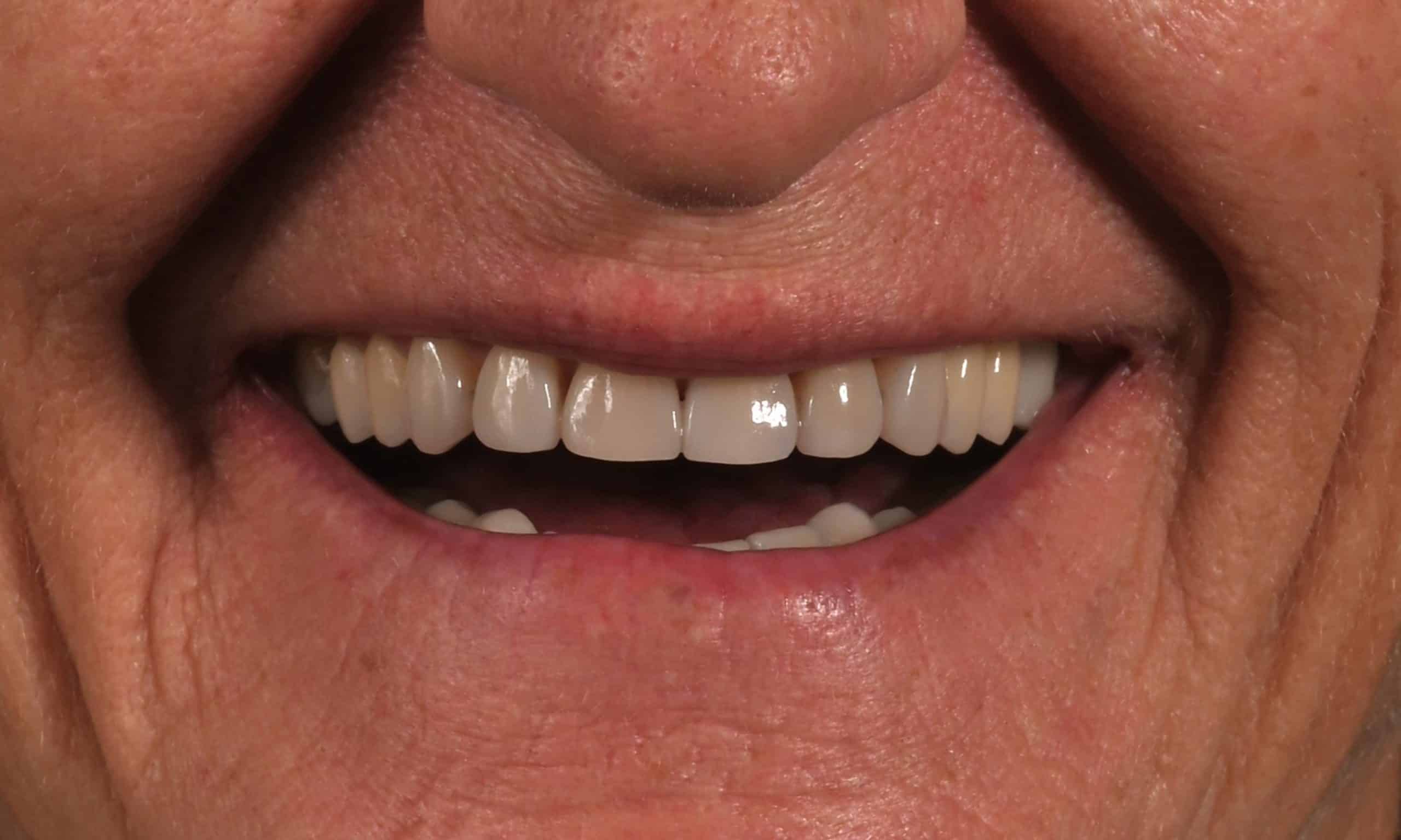 30