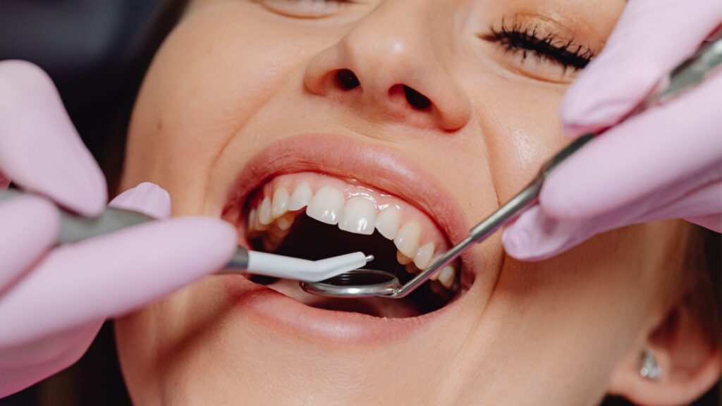 Au moindre signe de carie, une visite chez le dentiste s’impose.