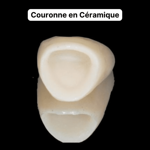Les Couronnes Dentaires Tout ce que Vous Devez Savoir Paris Dental — free download